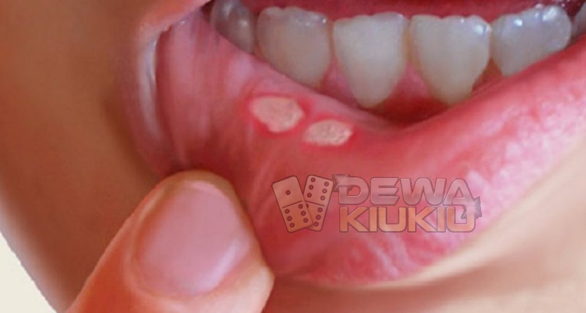 5 Kondisi Ini Normal Terjadi di Rongga Mulut, Jangan Panik!